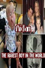 Watch Aidan The Rarest Boy In The World Online Putlocker
