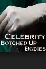 Watch Celebrity Botched Up Bodies Putlocker