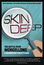Watch Skin Deep: The Battle Over Morgellons Putlocker