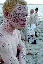 Watch Albino United Putlocker