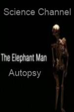 Watch Science Channel Elephant Man Autopsy Putlocker