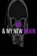 Watch Me & My New Brain Putlocker