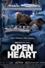 Watch Open Heart Putlocker