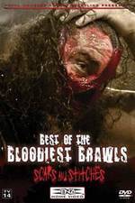 Watch TNA Wrestling: Best of the Bloodiest Brawls - Scars and Stitches Putlocker