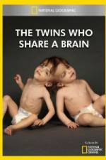 Watch National Geographic The Twins Who Share A Brain Putlocker